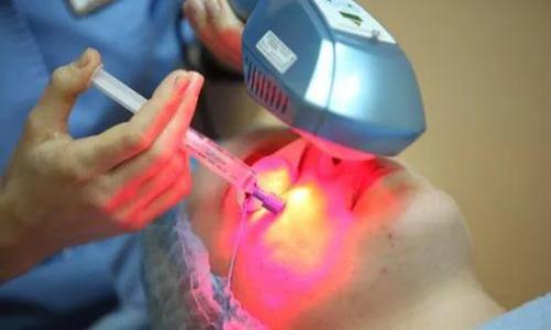 Positive and negative effects of laser radiation on the human body